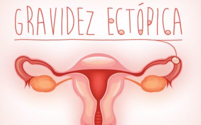 Tratamento hormonal para a gravidez ectópica