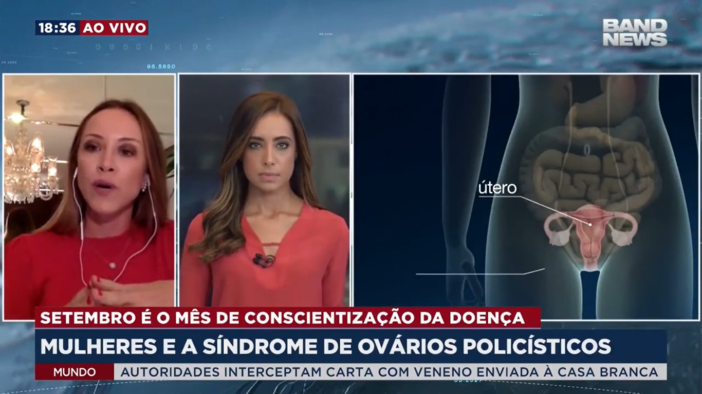 Dra. Melissa Cavagnoli em entrevista para a Band News explicando o que é ovário policístico.