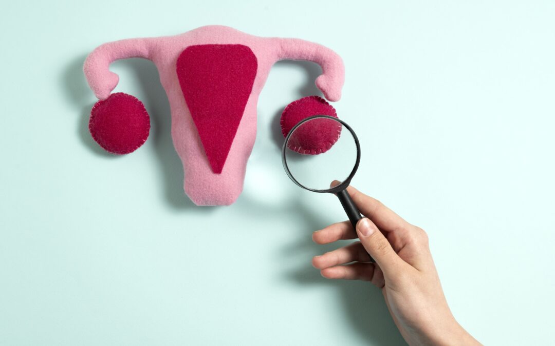 Qual é a relação entre síndrome dos ovários policísticos e fertilidade?